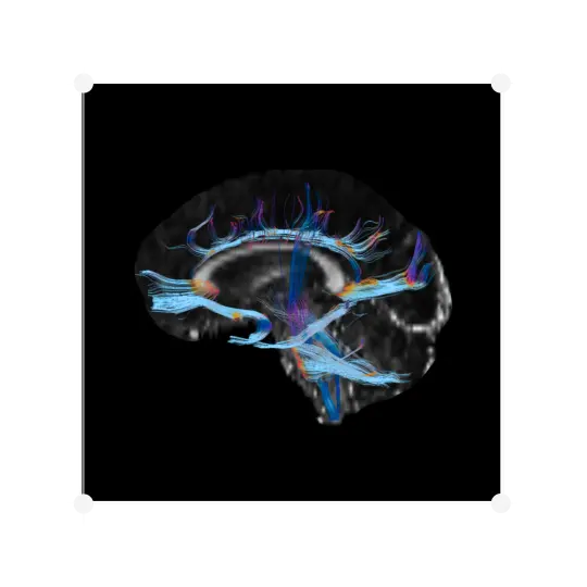 Diffusion Tensor Imaging (DTI)